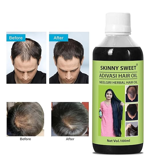 Adivasi Neelgiri Herbal Hair Oil Buy 1 Get 1 Free🎁 4.9⭐⭐⭐⭐⭐ (999+)